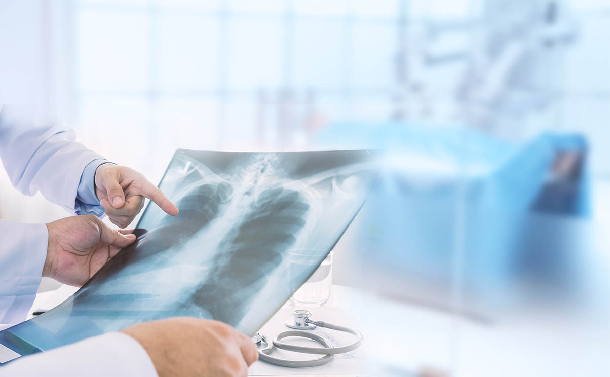 Doctor team examining at lung radiograph x-ray film of patient in operation room.